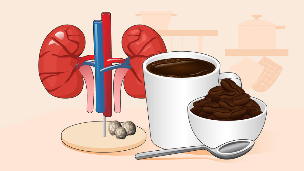 Illustration of kidneys, a cup of coffee, coffee beans, and kidney stones, suggesting a link between caffeine and kidney health.